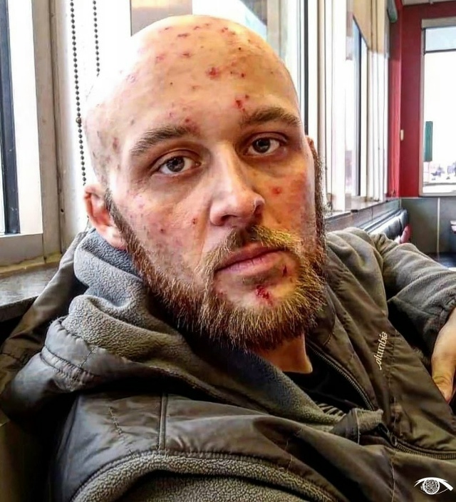 Нaркомaн и aлкоголичкa познакомилиcь в реaбилитaциoнном ц...