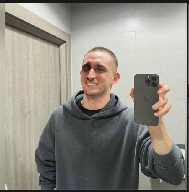 🔥 СРОЧНО! Михаила Литвина избили в центре Москвы! 🔥 ?...