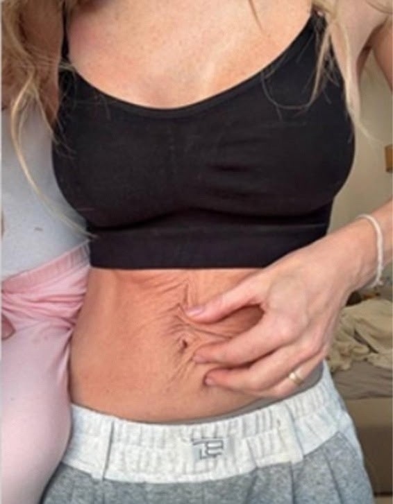 Анна Хилькевич смело поделилась своей фотографией пос...