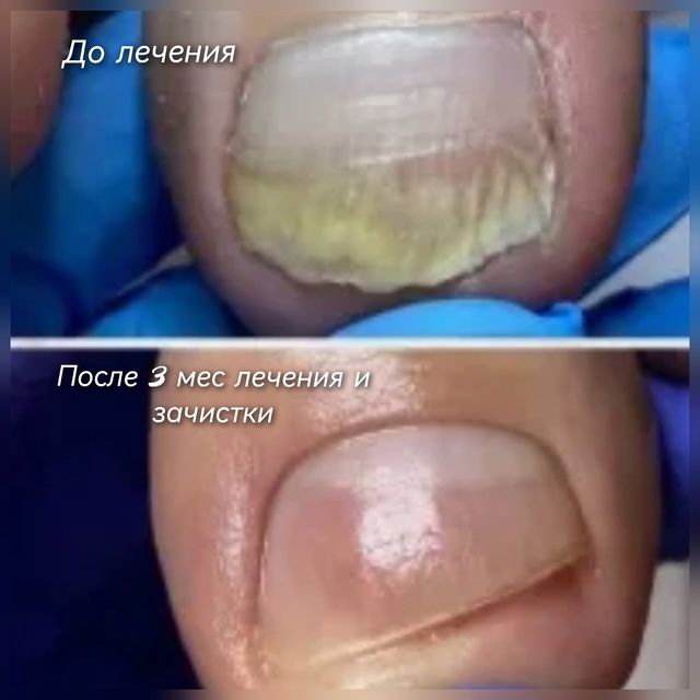 Специалист-подолог приглашает жителей Акбулака и близ...