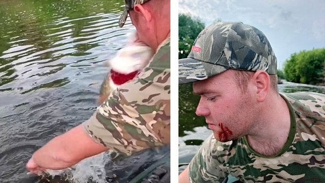 Щука укусила в лицо рыбака из Челябинской области
Жи?...
