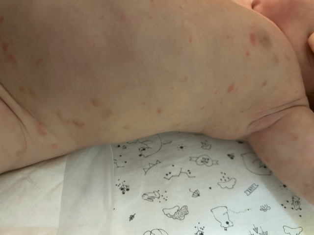 SOS‼️помогите, пожалуйста, вpачи не могут сказать что э?...