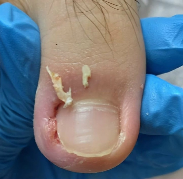 Специалист-подолог приглашает жителей Акбулака и близ...