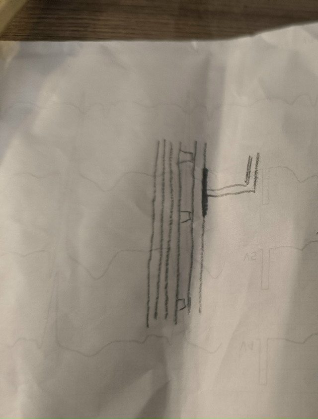 Анонимно.
Здравствуйте. Хочу попросить помощи у масте?...