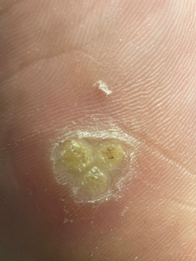 Добрый день!
С 14.11-16.11 ведет прием Нижегородский подоло?...