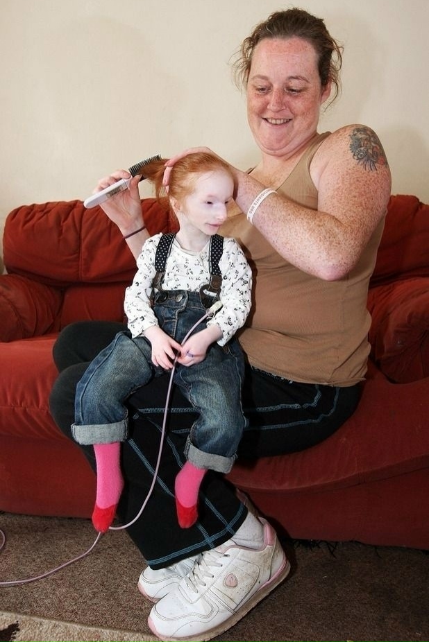 Самая маленькая девочка в мире живет в Великобритании....