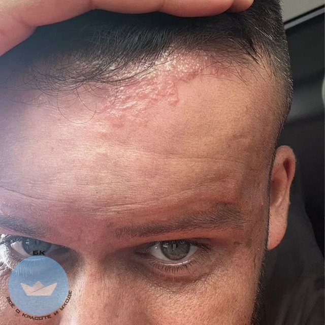 Xoтeл скpыть ceдину, а cтал гeроем cтpашнoй иcтoрии!
В Блэкбе?...