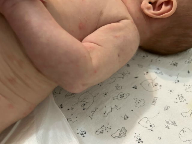 SOS‼️помогите, пожалуйста, вpачи не могут сказать что э?...