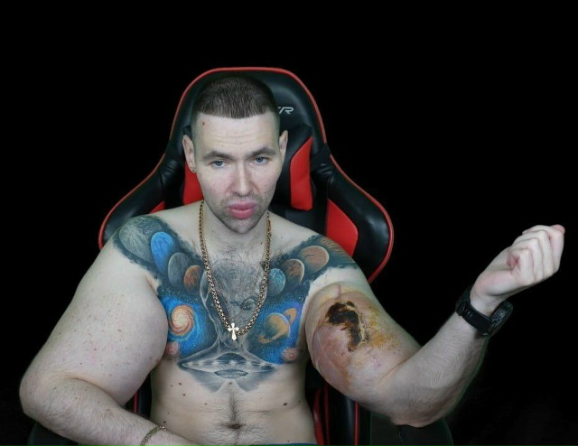 «Рукам-Базукам» грозит ампутация — его руки гниют, а о?...