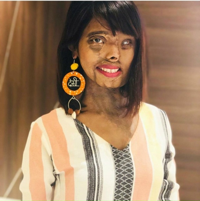 Анмол Родригес из Мумбаи, Индия, ослепла на один глаз и ...