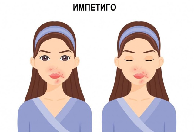 Поцелуи с бородатыми парнями могут обернуться неприят...