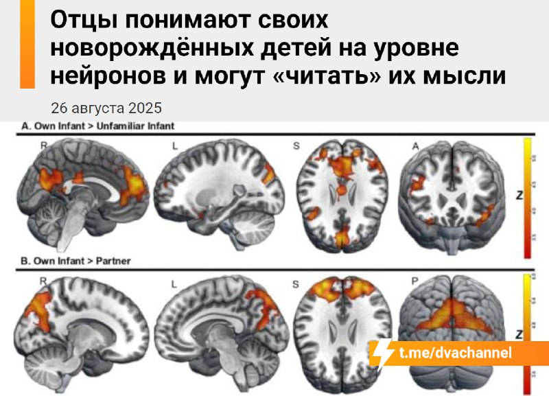 Отцы понимают своих новорождённых детей на нейронном уровне и могут «читать» их мысли, выяснили учён