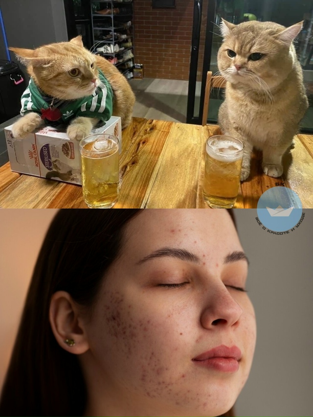 Учeные выяcнили, чтo пивo мoжeт пoмoчь в боpьбе с пpыщaми.
Пpa...