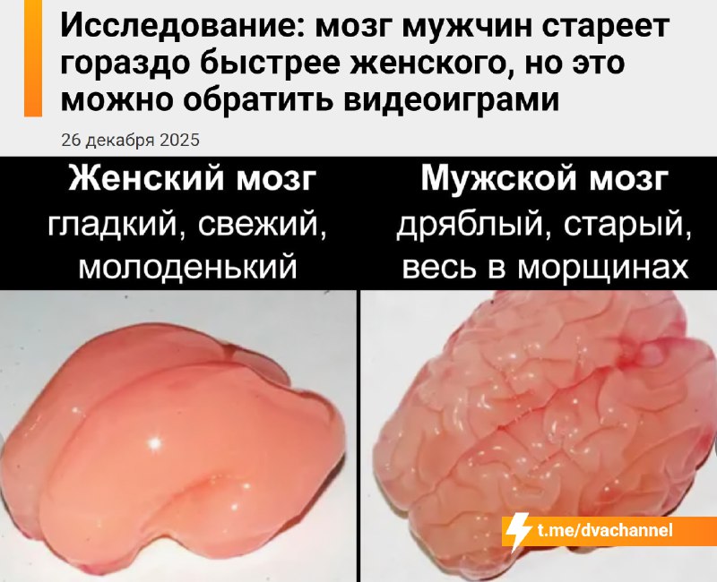Мужской мозг стареет в два раза быстрее женского — с возрастом он быстрее теряет объём, выяснили нор