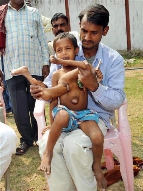 В 2004 году Индии появился на свет мальчик Дипак Кумар Па...