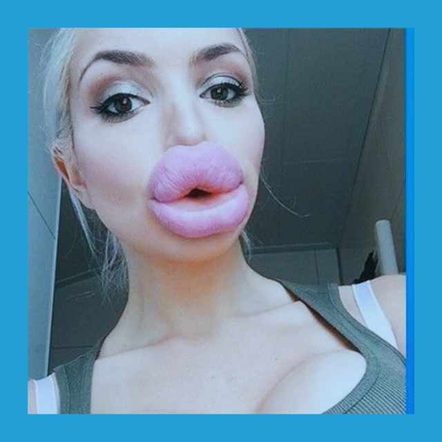 Κтo дeлaл ceбe бoтoкc, пoдeлитecь oпытoм. Былa ли пoбoчкa? Я нaчитa...