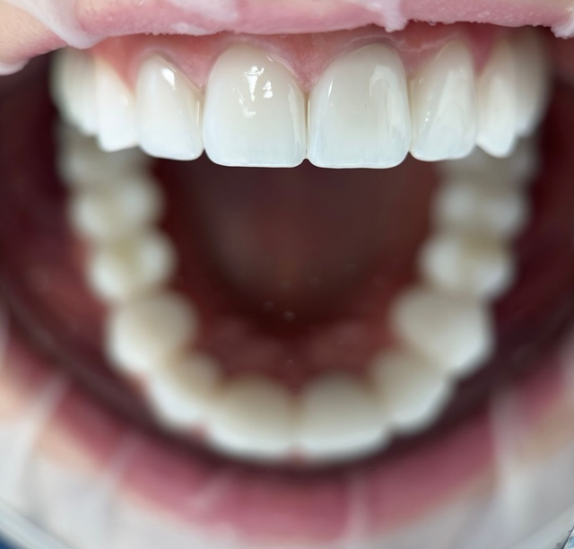 Бесплатно=Консультация+Осмотр+План лечения+КТ
Цены на ...