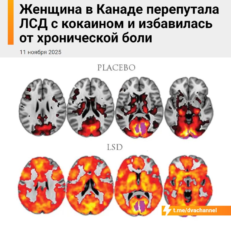 Жительница Канады по ошибке снюхала 55 миллиграммов чистого ЛСД, приняв его за кокаин. Что могло пой