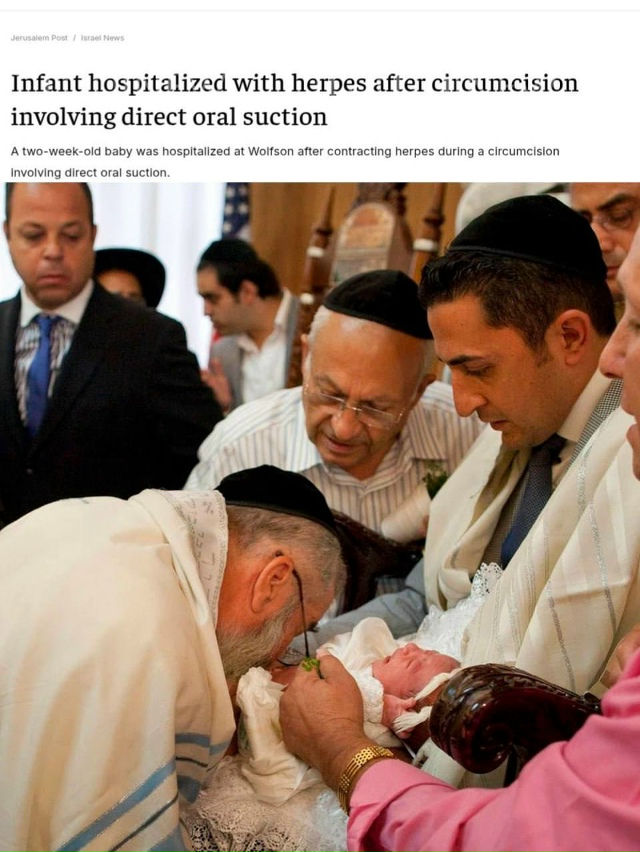 😳Раввин отсосал кровь из ранки на пенисе младенца пос...