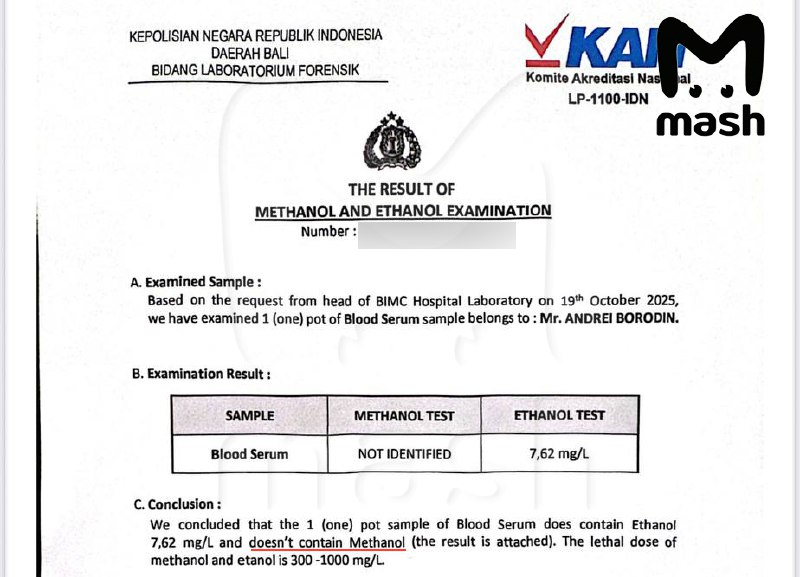 Российский турист умер на Бали от укуса ядовитой змеи, на которую не обратил внимания. Парень больше
