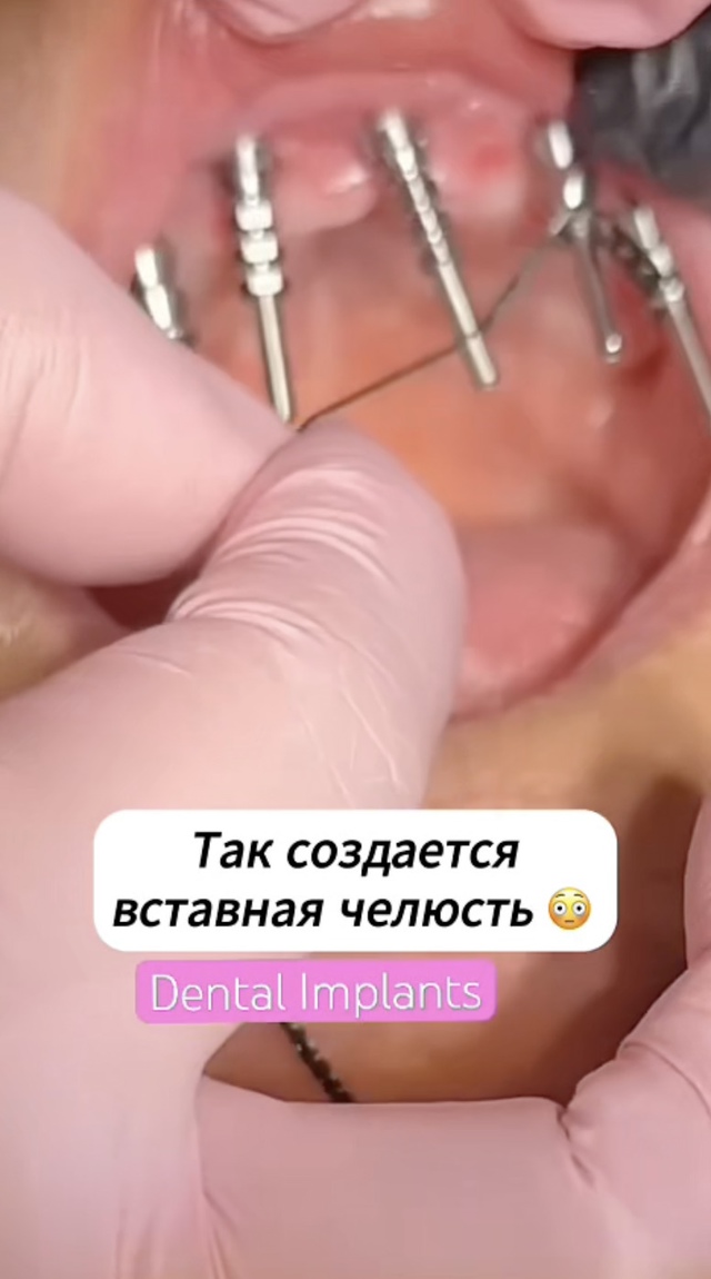 Не самое приятное занятие