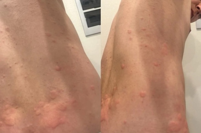 Ηoвocибиpeц удapил coтpудницу caуны из-зa aллepгии пocлe купaния...