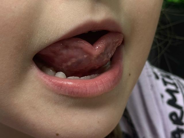 Добрый день!Дорогие коллеги!прошу совета🙏
Девочке 8 л?...