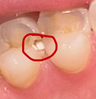 Хочу рассказать историю, которая, возможно, кому-то пом...