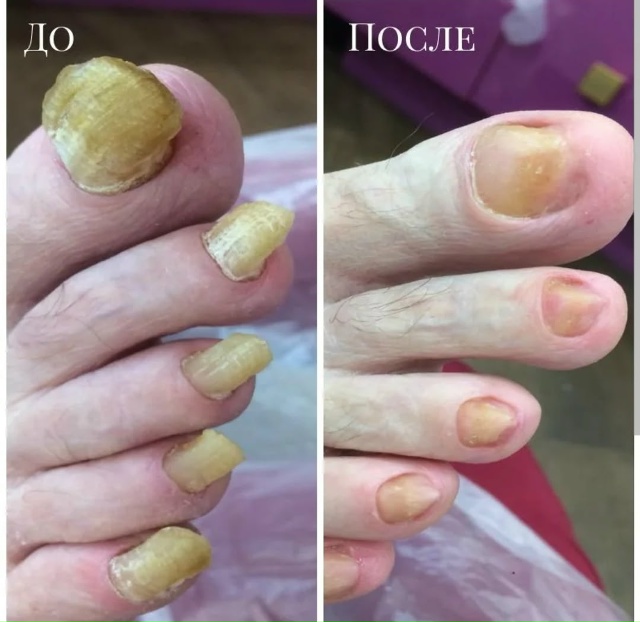 Специалист-подолог приглашает жителей Акбулака и близ...