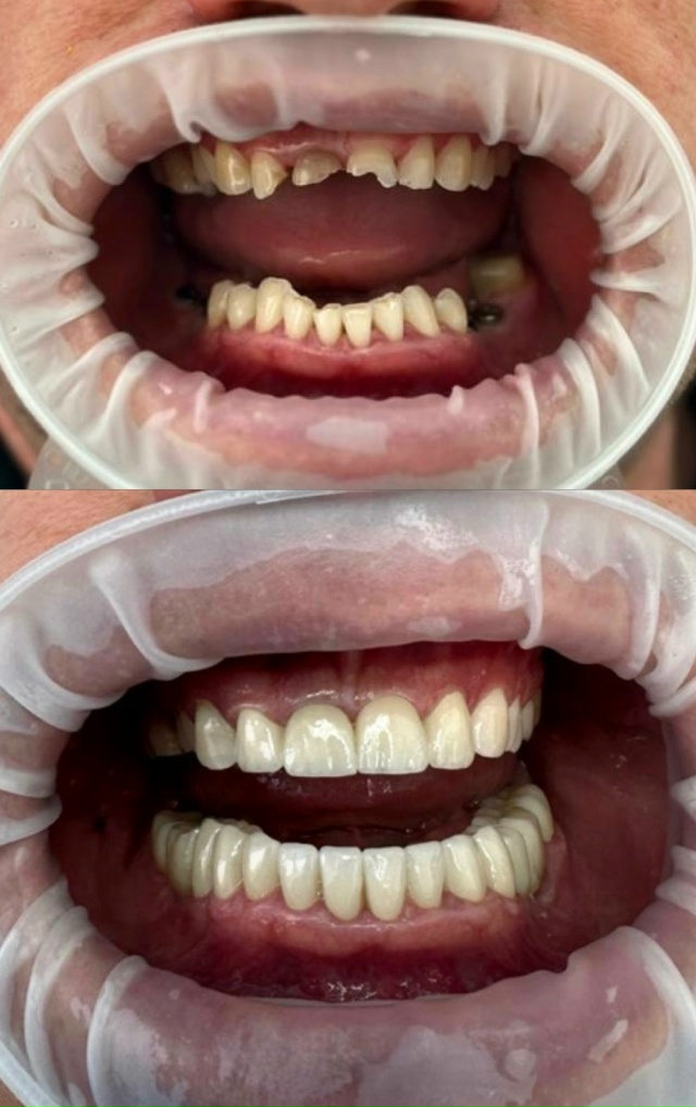 СТОМАТОЛОГИЯ Эмидент 📲 8-800-555-73-67 • nfk.emident.ru
🏠 Нефтека...