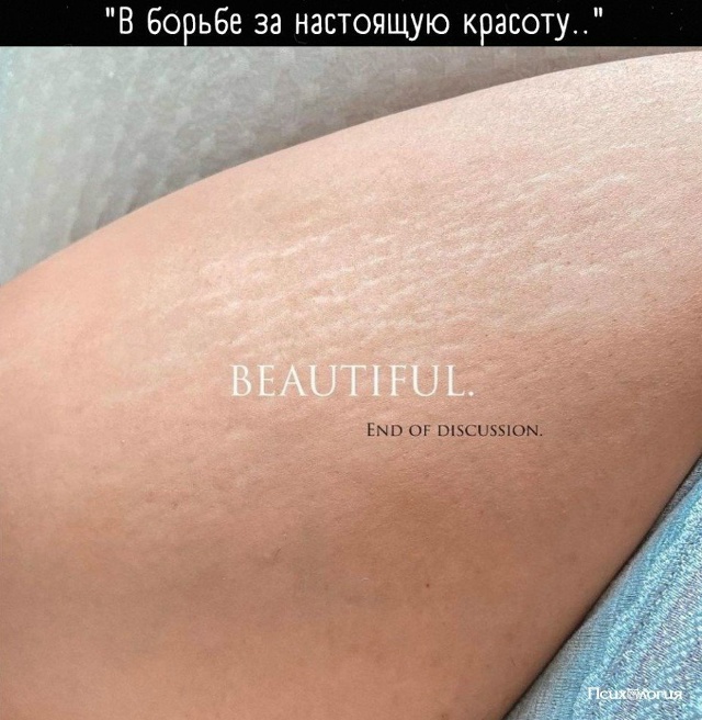 Не нужно стеснятся своих растяжек. Это не приговор!