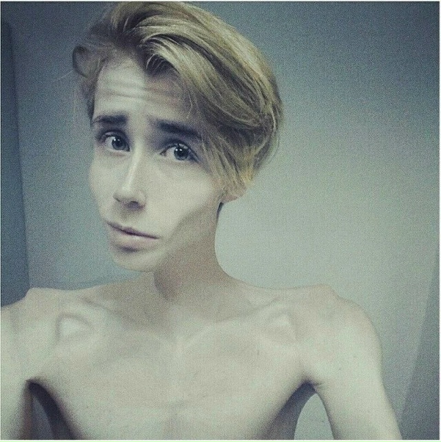 Стас Милеев с малых лет был мальчишкой в теле но ради т?...