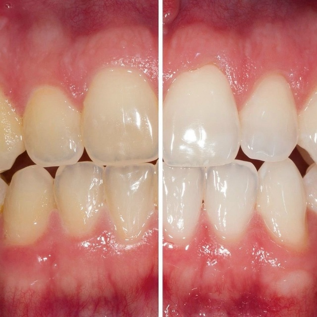 ? Академия Улыбки — ваша улыбка в надежных руках! ?
?...