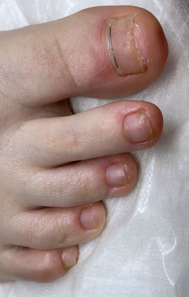 Добрый день!
С 14.11-16.11 ведет прием Нижегородский подоло?...