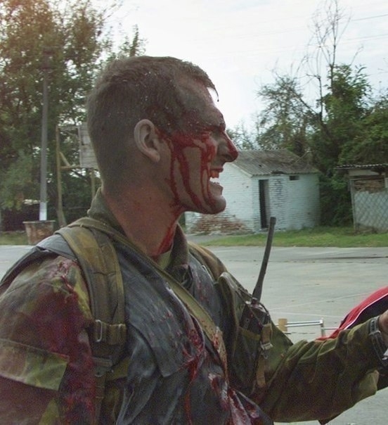 Этого раненого офицера западные журналисты позже проз...