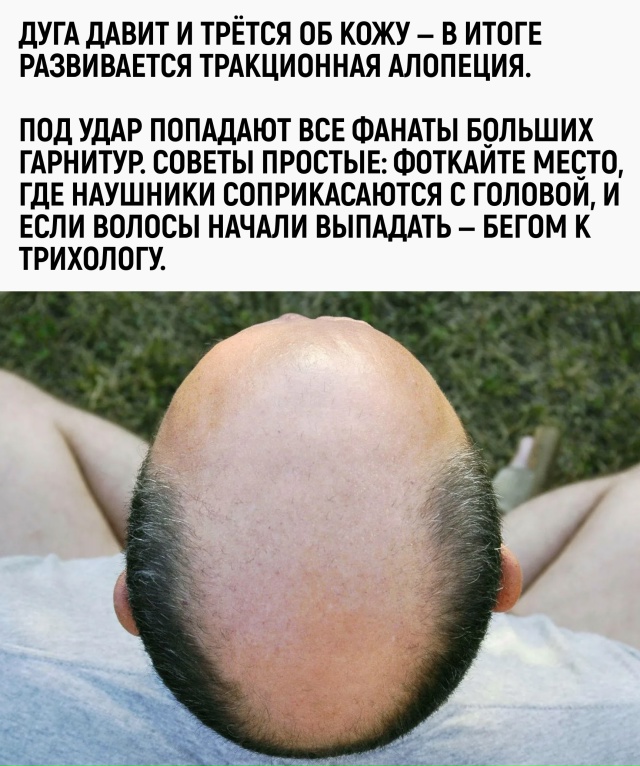 Раньше лысина считалась признаком мудрости. Теперь — ?...