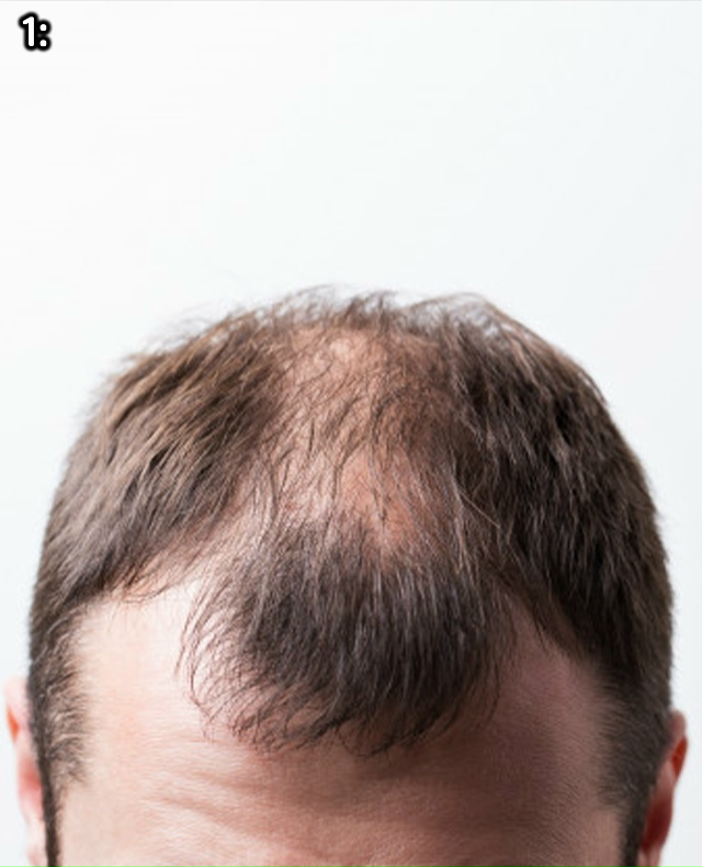 Они ещё и стакаются...