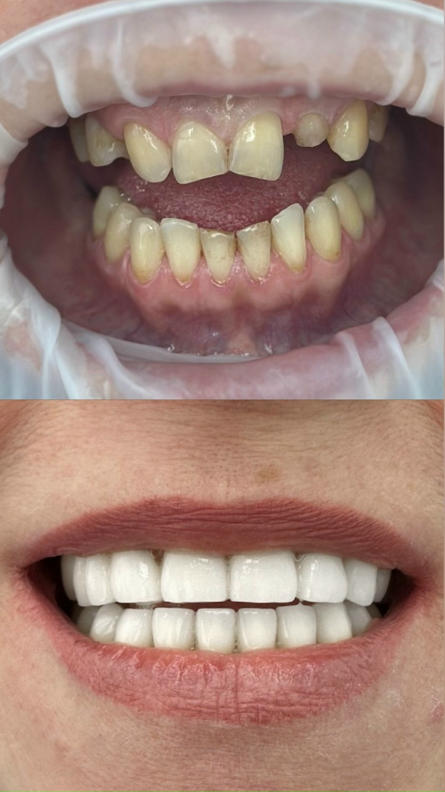 СТОМАТОЛОГИЯ Эмидент 📲 8-800-555-73-67 • nfk.emident.ru
🏠 Нефтека...