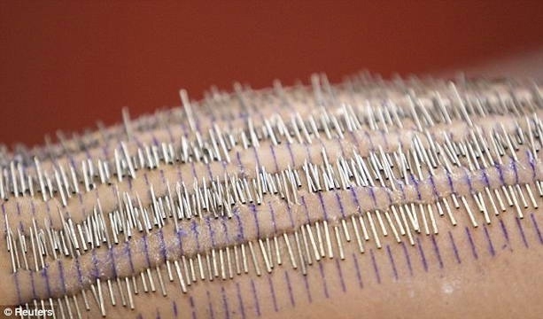 Американка из Лас-Вегаса Стейша Рэндалл согласилась н?...