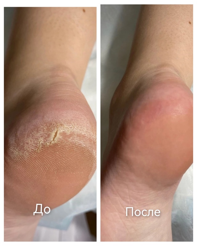 Специалист-подолог приглашает жителей Акбулака и близ...
