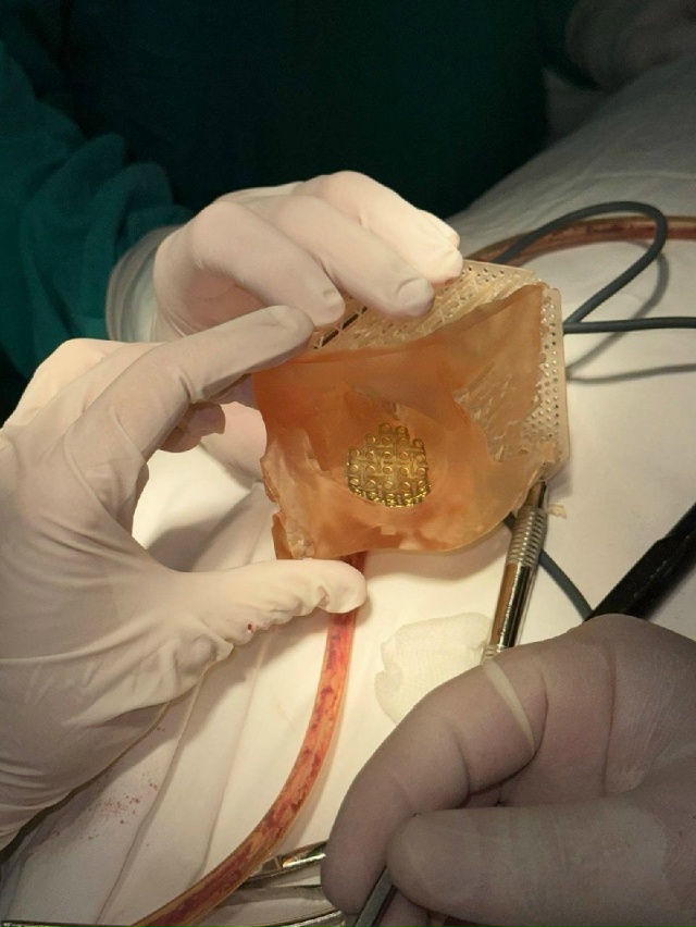 ?❤В Башкирии врачи успешно восстановили часть лица б...