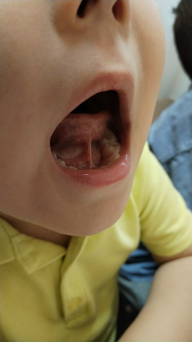 Реб 4.10 мес. Нужна ли Коррекция тут??