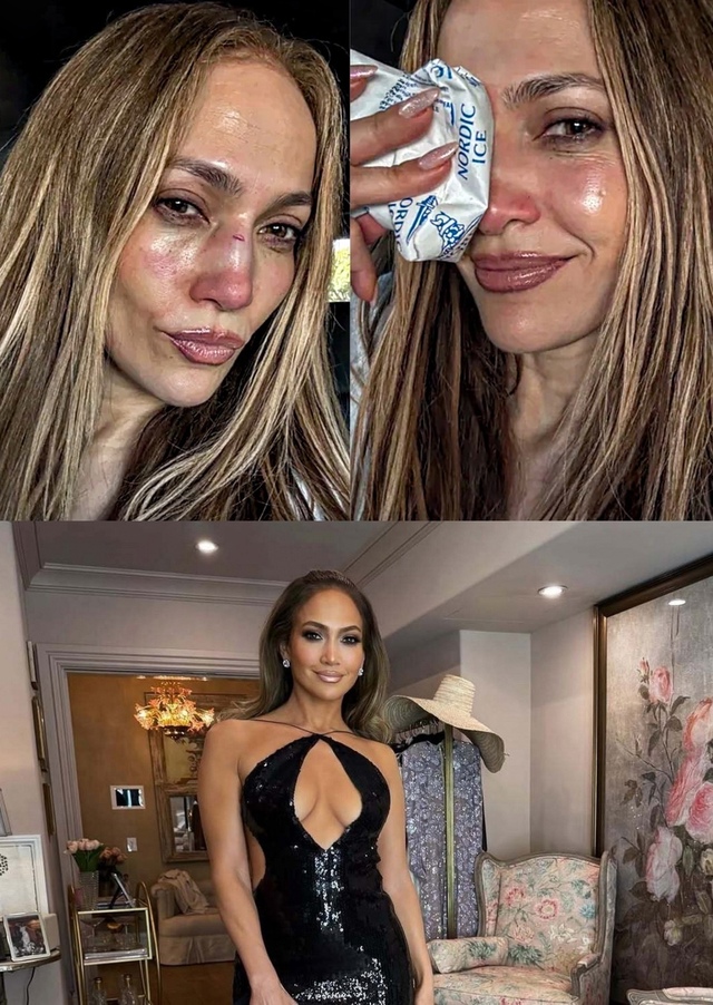 ‼ «Я РАЗБИЛА НОС» Дженнифер Лопес разбила себе нос во ?...