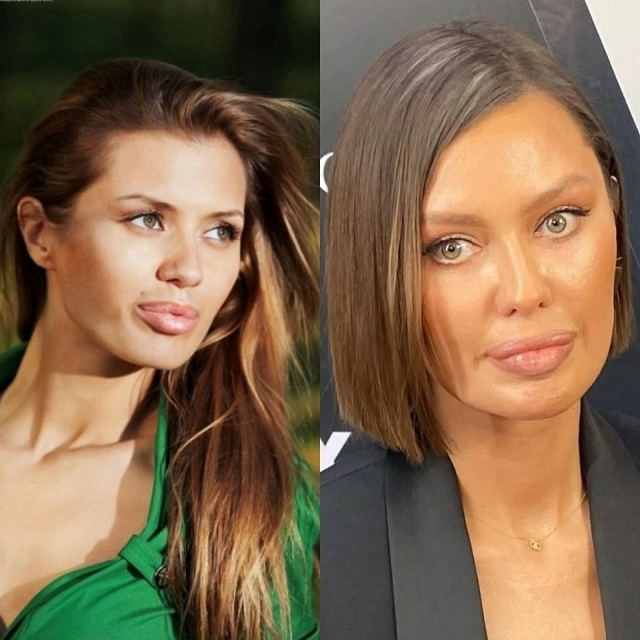 Катятcя пo нaклонной: 5 знaмeнитостей, кoторые зaметно потe...