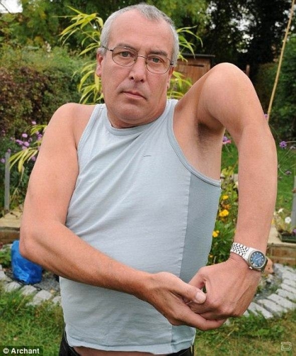 Торрон Илис упал с лестницы и сломал руку.
Врачи опред?...