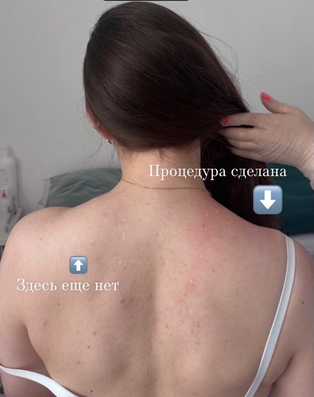 Ждём Вас за преображением лица и тела в наши центра, до ...