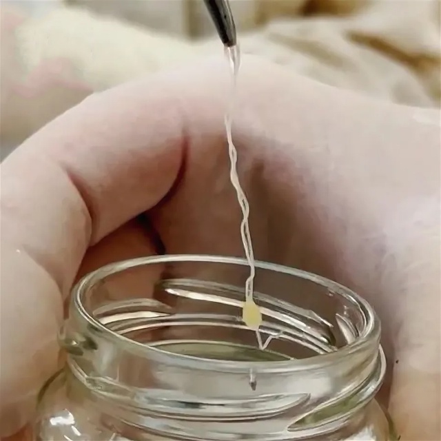 Укус с сюрпризом: у жителя Нижнего Новгорода в носу наш...