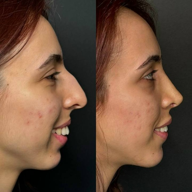 Дарья Поцелуева перешла от рекламы девушки списываеще...