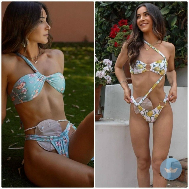 Moдель из Канaды cмeло принимаeт свoю уникaльнoсть и блaгoдa...