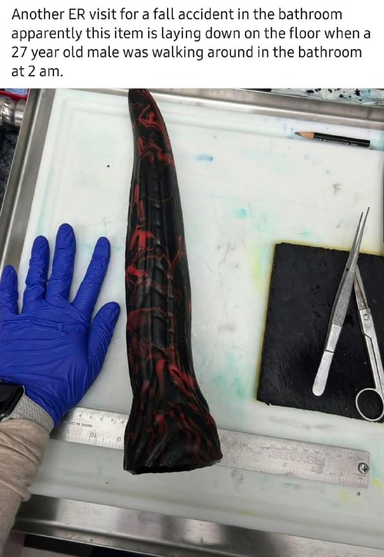 Врач из неотложки рассказал о трагичном случае с его пациентом — парень случайно упал на 30-сантимет